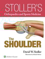 Stoller’s Orthopaedics and Sports Medicine: The Shoulder