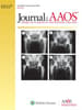 JAAOS®,  - Journal of the American Academy of Orthopaedic Surgeons