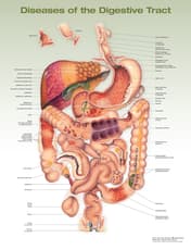 Diseases of the Digestive Tract Anatomical Chart