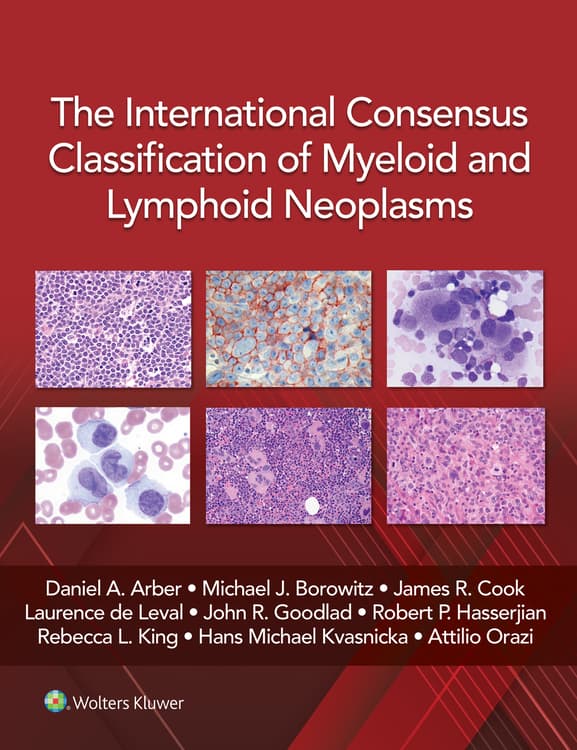 The International Consensus Classification of Myeloid and Lymphoid Neoplasms