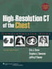 VitalSource E-book for High-Resolution CT of the Chest