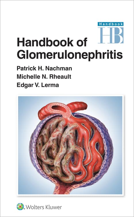 Handbook of Glomerulonephritis