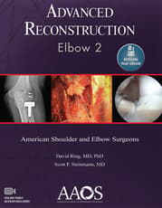 Advanced Reconstruction: Elbow 2: Ebook without Multimedia