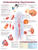 Understanding Hypertension Anatomical Chart