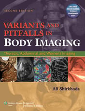 Variants and Pitfalls in Body Imaging