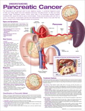 Understanding Pancreatic Cancer Anatomical Chart