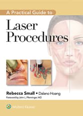 A Practical Guide to Laser Procedures