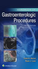Handbook of Gastreoenterologic Procedures