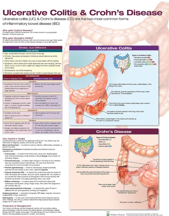 Ulcerative Colitis & Crohn's Disease