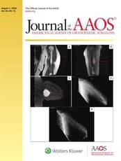 JAAOS®,  - Journal of the American Academy of Orthopaedic Surgeons