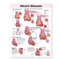 Heart Disease Anatomical Chart