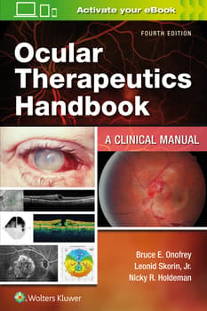 Ocular Therapeutics Handbook