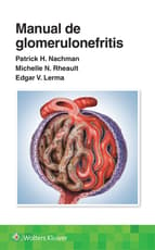 Manual de glomerulonefritis