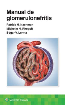 Manual de glomerulonefritis