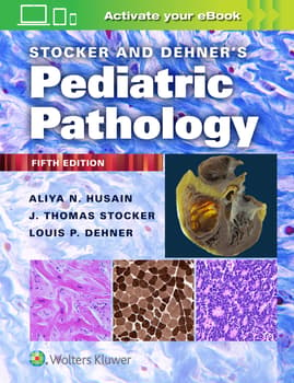 image of Stocker and Dehner's Pediatric Pathology