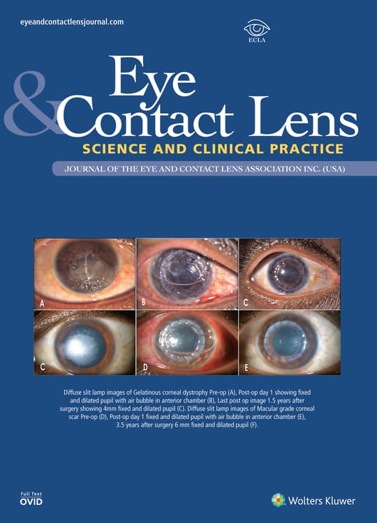 Eye and Contact Lens: Science and Clinical Practice Online