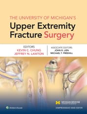 The University of Michigan's Upper Extremity Fracture Surgery