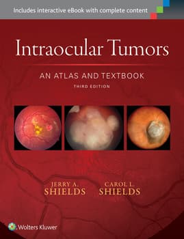 Intraocular Tumors: An Atlas and Textbook