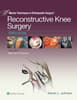 Master Techniques in Orthopaedic Surgery: Reconstructive Knee Surgery