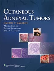 Cutaneous Adnexal Tumors