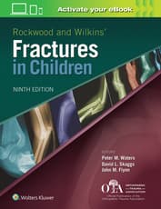 Rockwood and Wilkins Fractures in Children