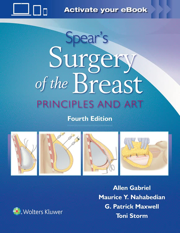 Spear's Surgery of the Breast