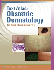 Text Atlas of Obstetric Dermatology