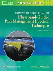 Comprehensive Atlas of Ultrasound-Guided Pain Management Injection Techniques