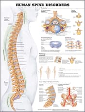The Female Muscular System Anatomical Chart (Laminated) — Massage