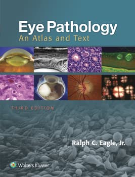 Eye Pathology