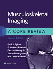 Musculoskeletal Imaging: A Core Review