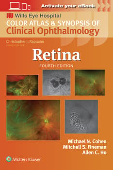 Retina