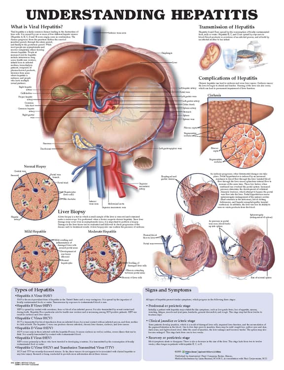 Understanding Hepatitis Anatomical Chart