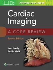 Cardiac Imaging: A Core Review