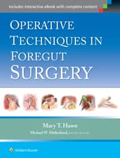 Operative Techniques in Foregut Surgery