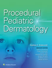 Procedural Pediatric Dermatology