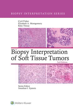 Biopsy Interpretation of Soft Tissue Tumors: eBook with Multimedia