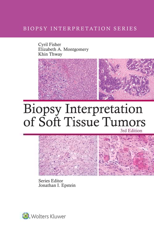 Biopsy Interpretation of Soft Tissue Tumors: eBook with Multimedia
