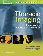 Thoracic Imaging