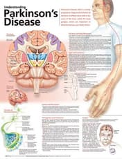 Understanding Parkinson's Disease Anatomical Chart