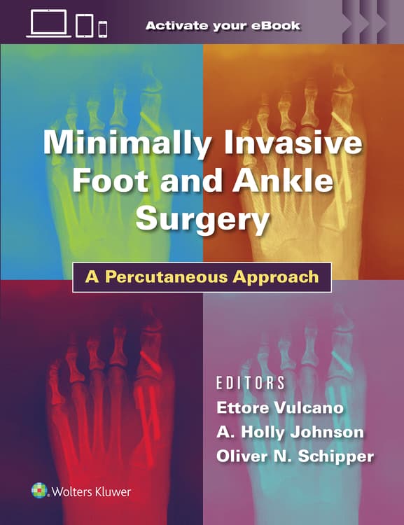 Minimally Invasive Foot And Ankle Surgery 1292