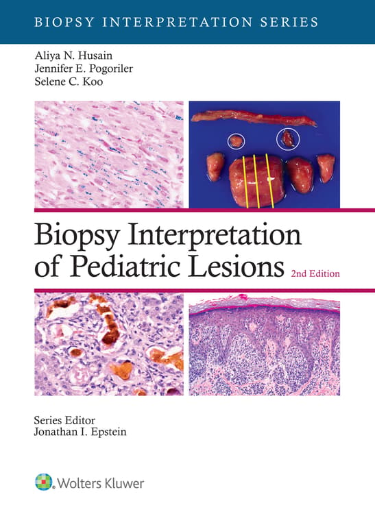 Biopsy Interpretation of Pediatric Lesions: eBook with Multimedia