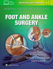 Hospital for Special Surgery's Illustrated Tips and Tricks in Foot and Ankle Surgery