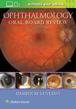 Ophthalmology Oral Board Review