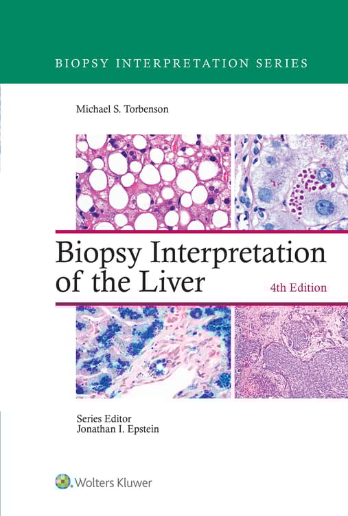 Biopsy Interpretation of the Liver