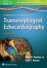 A Practical Approach to Transesophageal Echocardiography