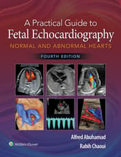 A Practical Guide to Fetal Echocardiography