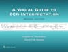 A Visual Guide to ECG Interpretation