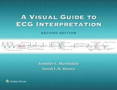 A Visual Guide to ECG Interpretation