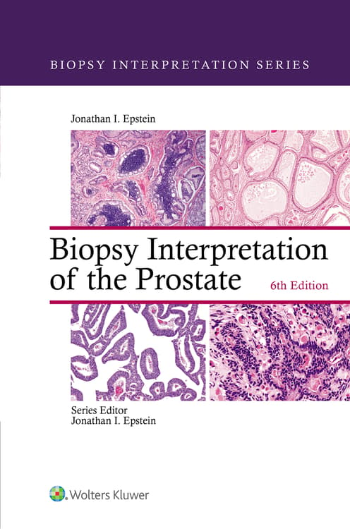 Biopsy Interpretation of the Prostate